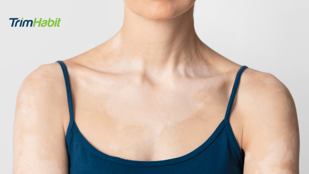 The Influence Of Intermittent Fasting On Autoimmune Diseases
